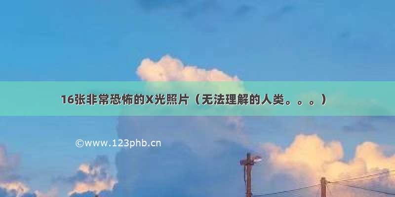 16张非常恐怖的X光照片（无法理解的人类。。。）